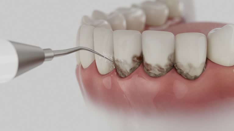 Reliable Root Canal Treatment contractor in Roane County County, WV by Dentist Open Now